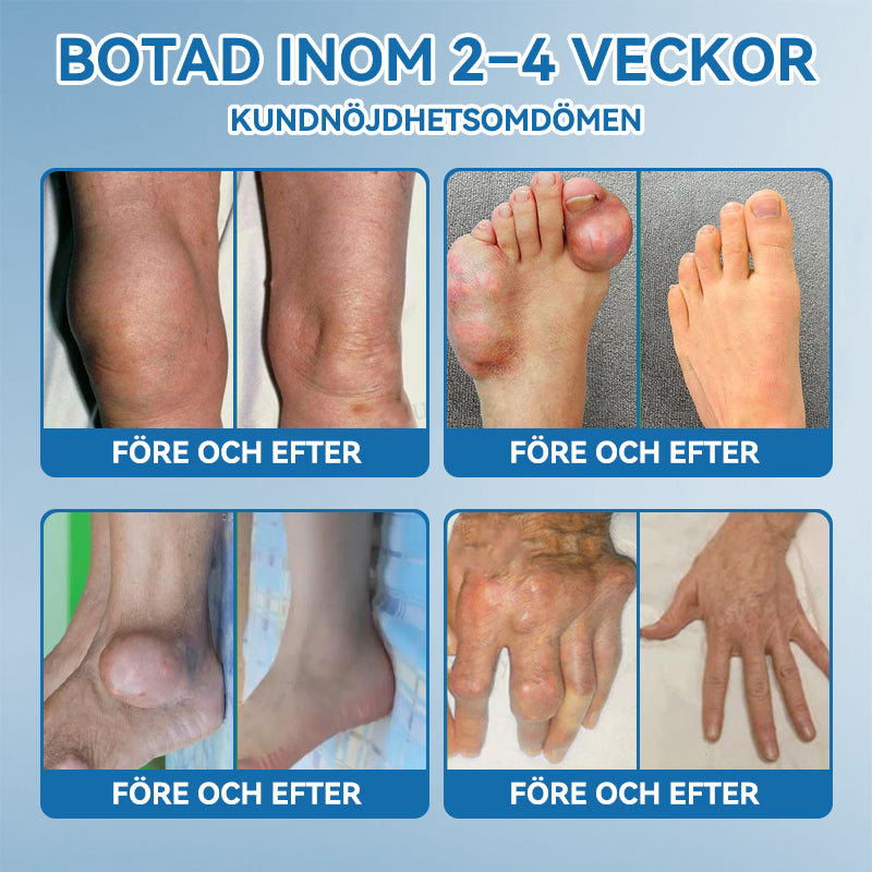 𝖯𝗂𝖼𝗱𝗼® BPC-157 Ledhälsande kräm🦴Behandlar artrit, neuropati, reumatism, idrottsskador och mer därtill👍
