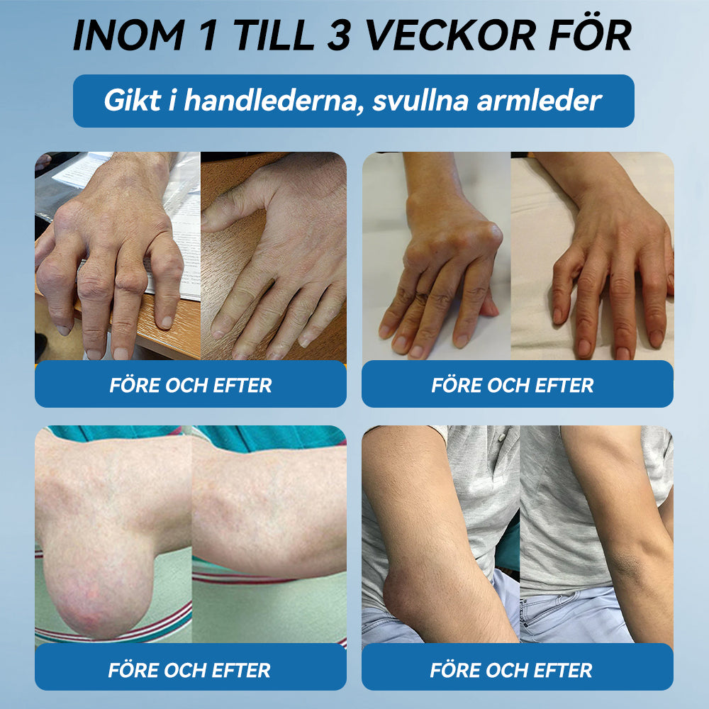 𝖯𝗂𝖼𝗱𝗼® BPC-157 Ledhälsande kräm🦴Behandlar artrit, neuropati, reumatism, idrottsskador och mer därtill👍