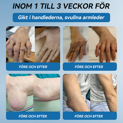 𝖯𝗂𝖼𝗱𝗼® BPC-157 Ledhälsande kräm🦴Behandlar artrit, neuropati, reumatism, idrottsskador och mer därtill👍