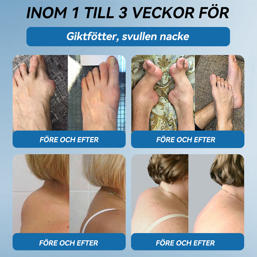 𝖯𝗂𝖼𝗱𝗼® BPC-157 Ledhälsande kräm🦴Behandlar artrit, neuropati, reumatism, idrottsskador och mer därtill👍